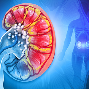 Kidney stone specialist in Vijayawada