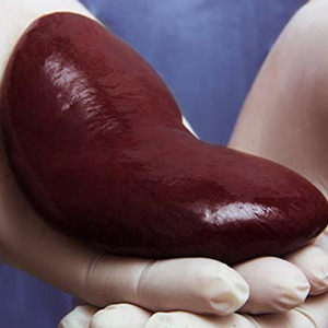 Best Nephrologist in Vijayawada for Kidney Transplant Care