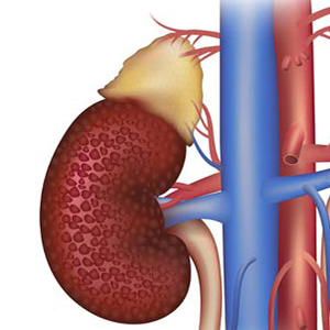 Nephrology consultation for diabetic kidney problems